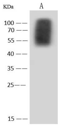 Western Blot Respiratory Syncytial Virus Subgroup A G Glycoprotein Antibody - Long - Azide and BSA Free